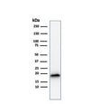 Western blot testing of human COLO-38 cell lysate with recombinant Melan-A antibody (clone rMLANA/788). Expected molecular weight ~20 kDa with possible doublet.