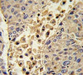 IHC testing of FFPE human tonsil tissue with Collectin 11 antibody. HIER: steam section in pH6 citrate buffer for 20 min and allow to cool prior to staining.