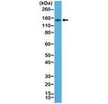 Western blot testing of human TT cell lysate with recombinant Thyroid Peroxidase antibody at 1:200. Predicted molecular weight ~103 kDa but may be observed at higher molecular weights due to glycosylation.