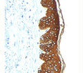 IHC: FFPE skin stained with Basic Cytokeratin antibody AE3.