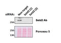 Western blot testing of mouse fibroblast lysates transiently expressing unrelated and two different siRNA with SETD2 antibody at 0.5ug/ml