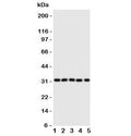 Western blot testing of Aquaporin 9 antibody and Lane 1: mouse liver; 2: (m) lung; 3: (m) spleen; 4: (m) testis; 5: rat PC-12 lysate. Predicted molecular weight ~32 kDa.