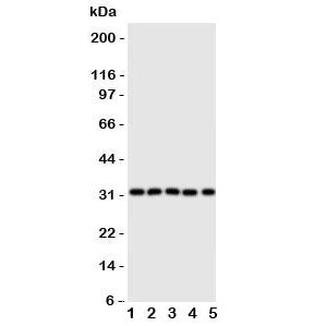 Western blot testing of Aquaporin 9 antibody and Lane 1: mouse liver; 2: (m) lung; 3: (m) spleen; 4: (m) testis; 5: rat PC-12 lysate. Predicted molecular weight ~32 kDa.
