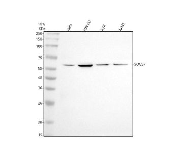 Western blot analysis of SOCS7 using anti-SOCS7 antibody. Lane 1: human Hela whole cell lysates, Lane 2: human HepG2 whole cell lysates, Lane 3: human RT4 whole cell lysates, Lane 4: human whole cell lysates. After electrophoresis, proteins were transferred to a nitrocellulose membrane at 150 mA for 50-90 min. Blocked the membrane with 5% non-fat milk/TBS for 1.5 hour at RT.
