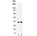 Western blot testing of Aquaporin 5 antibody and Lane 1: rat lung; 2: rat testis tissue lysate. Predicted molecular weight ~28 kDa.