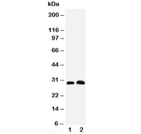 Western blot testing of Aquaporin 5 antibody and Lane 1: rat lung; 2: rat testis tissue lysate. Predicted molecular weight ~28 kDa.