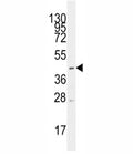 Western blot analysis of MCT1/ SLC16A1 antibody and CEM lysate.