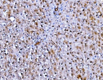 Immunofluorescent staining of FFPE rat liver cells with Fadd antibody (green) and DAPI nuclear stain (blue). HIER: steam section in pH6 citrate buffer for 20 min.