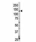Western blot analysis of ErbB4 / HER4 antibody and HL-60 cell lysate. Predicted molecular weight: 147-180 kDa (precursor), 120, 80 kDa (cleaved forms).