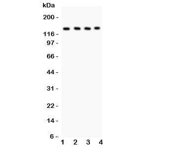 Western blot testing of PLCB1 antibody and Lane 1: rat brain; 2: mouse brain; 3: mouse testis; 4: human placenta lysate
