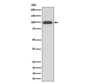 Western blot testing of human U-87 MG cell lysate with Integrin beta 3 antibody. Predicted molecular weight ~88 kDa but may be observed at higher molecular weights due to glycosylation.