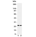 Western blot testing of IL6 antibody and Lane 1: mouse HEPA1-6; 2: (m) NIH3T3 lysate. Expected molecular weight ~24 kDa.