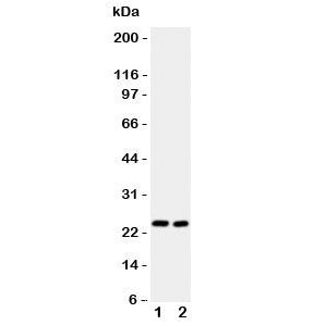 Western blot testing of IL6 antibody and Lane 1: mouse HEPA1-6; 2: (m) NIH3T3 lysate. Expected molecular weight ~24 kDa.