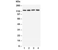 Western blot testing of TLR7 antibody and lysate from lane 1: rat spleen; 2: rat liver; 3: human U87 cells; 4: human A549 cells. Expected/observed molecular weight ~121 kDa.