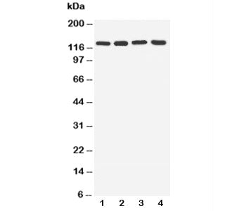 Western blot testing of TLR7 antibody and lysate from lane 1: rat spleen; 2: rat liver; 3: human U87 cells; 4: human A549 cells. Expected/observed molecular weight ~121 kDa.