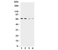 Western blot testing of CAT1 antibody and Lane 1: human placenta; 2: HeLa; 3: SKOV-3; 4: HT1080 cell lysate. Expected molecular weight ~68 kDa.
