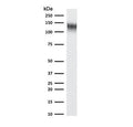 Western blot testing of human ThP1 cell lysate with recombinant CD31 antibody (clone RMCD31-1). Expected molecular weight: 83-130 kDa depending on level of glycosylation.