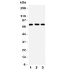 Western blot testing of VASA antibody and Lane 1: rat testis; 2: mouse testis; 3: HeLa cell lysate