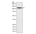 Western blot testing of human HeLa lysate with TLR5 antibody. Expected molecular weight ~98 kDa.