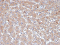 IHC staining of FFPE human liver tissue with Alpha-1-Antichymotrypsin antibody (clone SERPINA3/4189). HIER: boil tissue sections in pH 9 10mM Tris with 1mM EDTA for 20 min and allow to cool before testing.