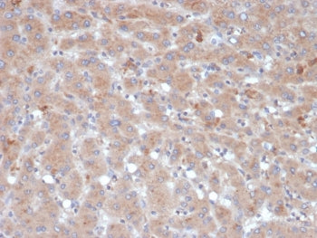 IHC staining of FFPE human liver tissue with Alpha-1-Antichymotrypsin antibody (clone SERPINA3/4189). HIER: boil tissue sections in pH 9 10mM Tris with 1mM EDTA for 20 min and allow to cool before testing.