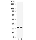 Western blot testing of 1) rat liver and 2) rat testis lysate with Apolipoprotein A I antibody. Predicted molecular weight ~30 kDa.