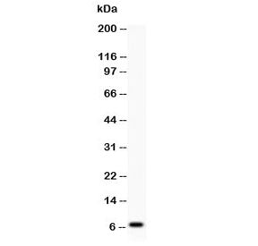 Western blot testing of Defensin 1 antibody and human COLO320 lysate; Predicted molecular weight ~7 kDa.