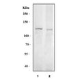 Western blot testing of human 1) PC-3 and 2) U-87 MG cell lysate with BK channel antibody. Predicted molecular weight: 130-140 kDa (multiple isoforms).