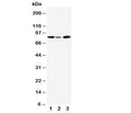 Western blot testing of MCM5 antibody and Lane 1: rat testis; 2: rat brain; 3: Jurkat cell lysate. Expected molecular weight: 80~90 kDa.