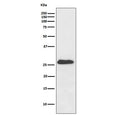 Western blot testing of mouse heart lysaste with NQO2 antibody. Predicted molecular weight ~26 kDa.