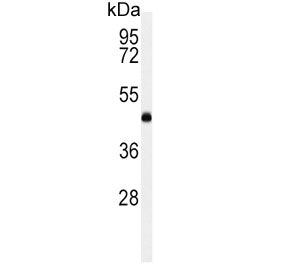 Western blot testing of human K562 cell lysate with LCAT antibody. Predicted molecular weight ~49 kDa.