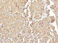 IHC: Formalin-fixed, paraffin-embedded human adrenal gland stained with Chromogranin A antibody (LK2H10 + PHE5).