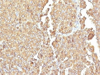IHC: Formalin-fixed, paraffin-embedded human adrenal gland stained with Chromogranin A antibody (LK2H10 + PHE5).