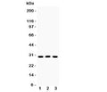 Western blot testing of HOXA9 antibody and Lane 1: rat testis; 2: human HEPG2; 3: mouse HEPA lysate. Expected/observed molecular weight: ~30kDa.