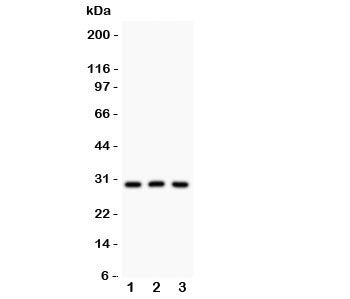 Western blot testing of HOXA9 antibody and Lane 1: rat testis; 2: human HEPG2; 3: mouse HEPA lysate. Expected/observed molecular weight: ~30kDa.