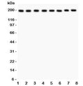 Western blot testing of ZO-1 antibody and Lane 1: rat liver; 2: mouse liver; 3: (r) NRK; 4: (r) PC12; 5: human HeLa; 6: (h) SMMC-7721; 7: (m) HEPA; 8: (h) COLO320 lysate. Predicted molecular weight: ~194 kDa.