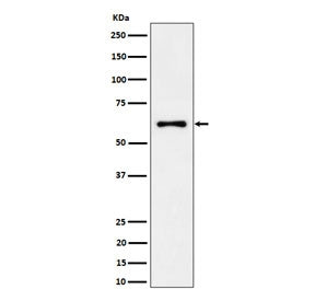 Western blot testing of human 293T cell lysate with EYA2 antibody. Predicted molecular weight ~59 kDa.