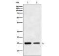 Western blot testing of human 1) HepG2 and 2) fetal liver lysate with TGFA antibody. Predicted molecular weight ~17 kDa.