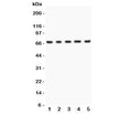 Western blot testing of Menin antibody and Lane 1: human HeLa; 2: (h) 293T; 3: (h) SMMC-7721; 4: mouse HEPA1-6; 5: (h) COLO320. Predicted molecular weight ~68 kDa.