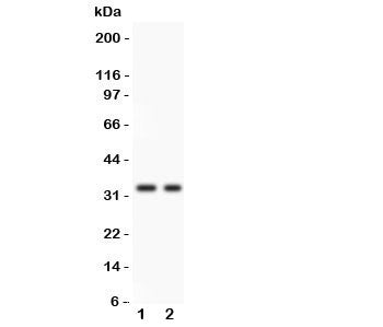 Western blot testing of SFRP2 antibody and 1. COLO320, 2. SW620 lysate. Predicted/observed molecular weight: ~33kDa.