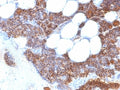 IHC: Formalin-fixed, paraffin-embedded human parathyroid stained with Parathyroid Hormone antibody (SPM604).