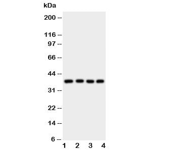 Western blot testing of Bmi1 antibody and Lane 1: HeLa; 2: HT1080; 3: COLO320; 4: MCF-7 cell lysate. Predicted molecular weight: 37-43 kDa.