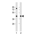 Western blot testing of human 1) HeLa and 2) Jurkat cell lysate with PRPF38A antibody. Predicted molecular weight ~37 kDa.