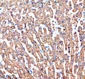 Immunohistochemical staining of SHARPIN using anti-SHARPIN antibody. SHARPIN was detected in a paraffin-embedded section of human liver tissue. Heat mediated antigen retrieval was performed in EDTA buffer (pH 8.0, epitope retrieval solution). The tissue section was blocked with 10% goat serum. The tissue section was then incubated with 2 ug/ml rabbit anti-SHARPIN antibody overnight at 4oC. Peroxidase Conjugated Goat Anti-rabbit IgG was used as secondary antibody and incubated for 30 min at 37oC.