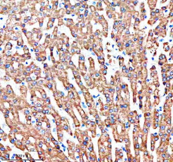 Immunohistochemical staining of SHARPIN using anti-SHARPIN antibody. SHARPIN was detected in a paraffin-embedded section of human liver tissue. Heat mediated antigen retrieval was performed in EDTA buffer (pH 8.0, epitope retrieval solution). The tissue section was blocked with 10% goat serum. The tissue section was then incubated with 2 ug/ml rabbit anti-SHARPIN antibody overnight at 4oC. Peroxidase Conjugated Goat Anti-rabbit IgG was used as secondary antibody and incubated for 30 min at 37oC.