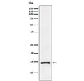Western blot testing of human PC-3 cell lysate with Atrial Natriuretic Peptide antibody. Predicted molecular weight ~17 kDa.