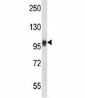 NFATC1 antibody western blot analysis in NCI-H292 lysate. Predicted molecular weight ~101 kDa (isoform C).