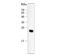 Western blot testing of human placental tissue with PP14 antibody. Predicted molecular weight ~21 kDa but may be observed at higher molecular weights due to glycosylation.