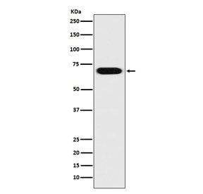 Western blot testing of human HeLa cell lysate with PRC1 antibody. Expected molecular weight ~70-80 kDa, may be observed as a doublet.