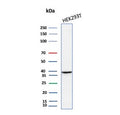 Western blot testing of human HEK293 cell lysate with AKR1B1 antibody (clone rAKR1B1/7295). Predicted molecular weight ~36 kDa.